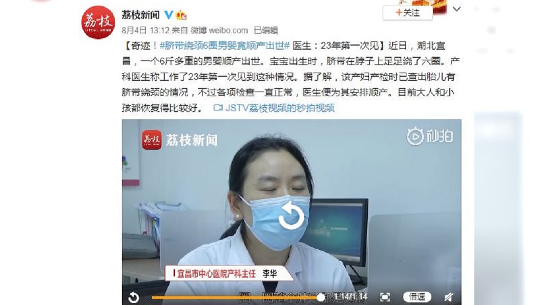負責接生的醫師事後也直呼,自己從醫23年首次看到。(圖/翻攝自荔枝新聞微博)