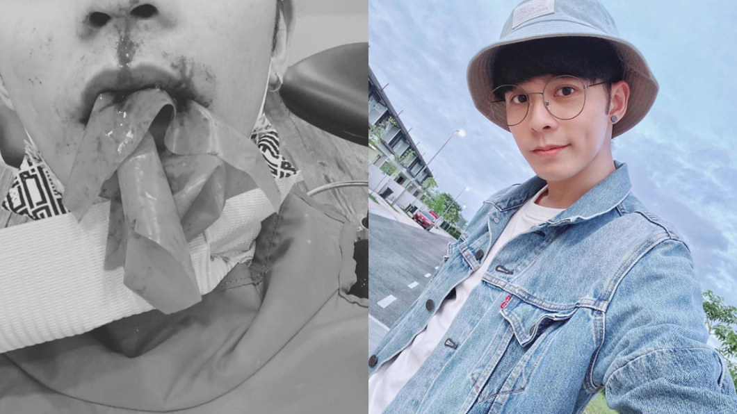 牙齦發炎2年不管 男歌手骨頭遭細菌侵蝕:可能會毀容…