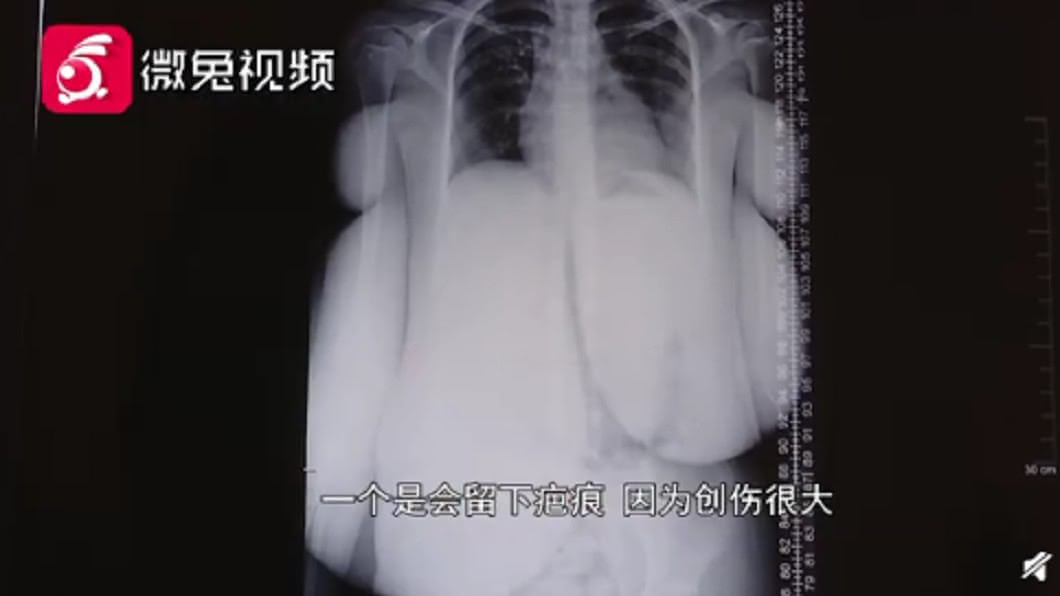 (圖/翻攝自微兔視頻)