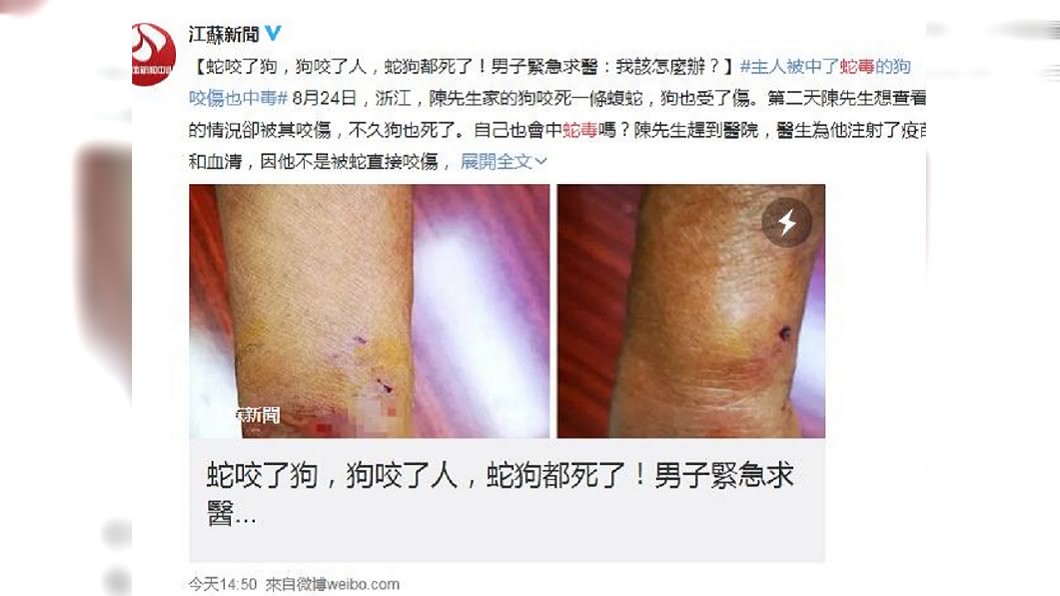 所幸男子經過治療已經康復出院。(圖/翻攝自微博)