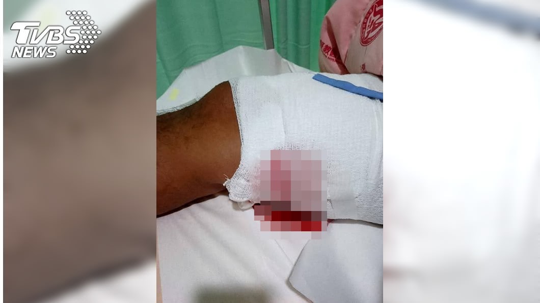利齒猛撕「20CM大腿肉噴地」! 雲林比特犬撲啃騎士