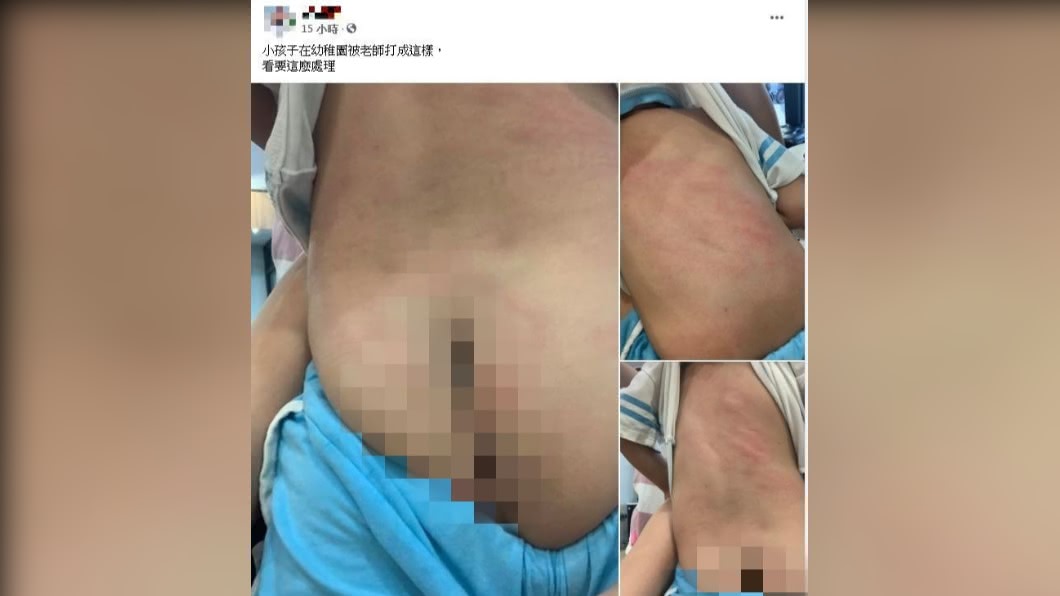 3歲童尿褲子遭教師毆打。(圖/翻攝自民眾臉書)