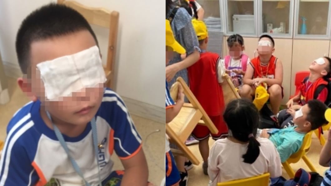 「紫外線燈」狂照5小時 130學生眼睛灼傷、角膜脫落