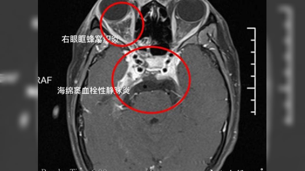 (圖/翻攝自中國寧波)