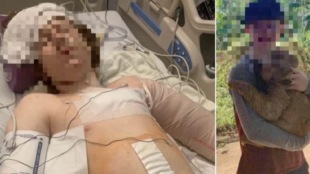 朝13歲自閉症童連開數槍 美警又執法過當