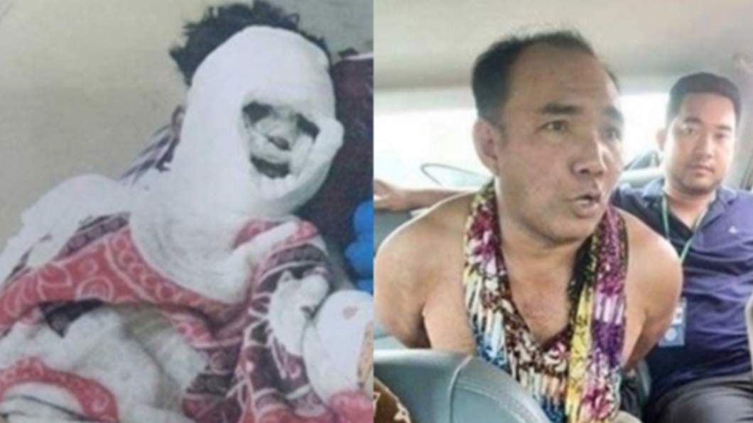 驚悚!不滿女友提分手 恐怖情人持刀剁掌潑酸毀容