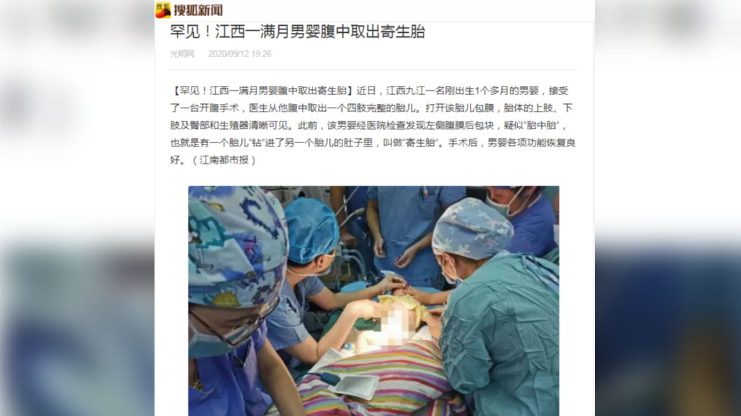 男嬰體內竟有「寄生胎」。（圖／翻攝自《搜狐新聞》）