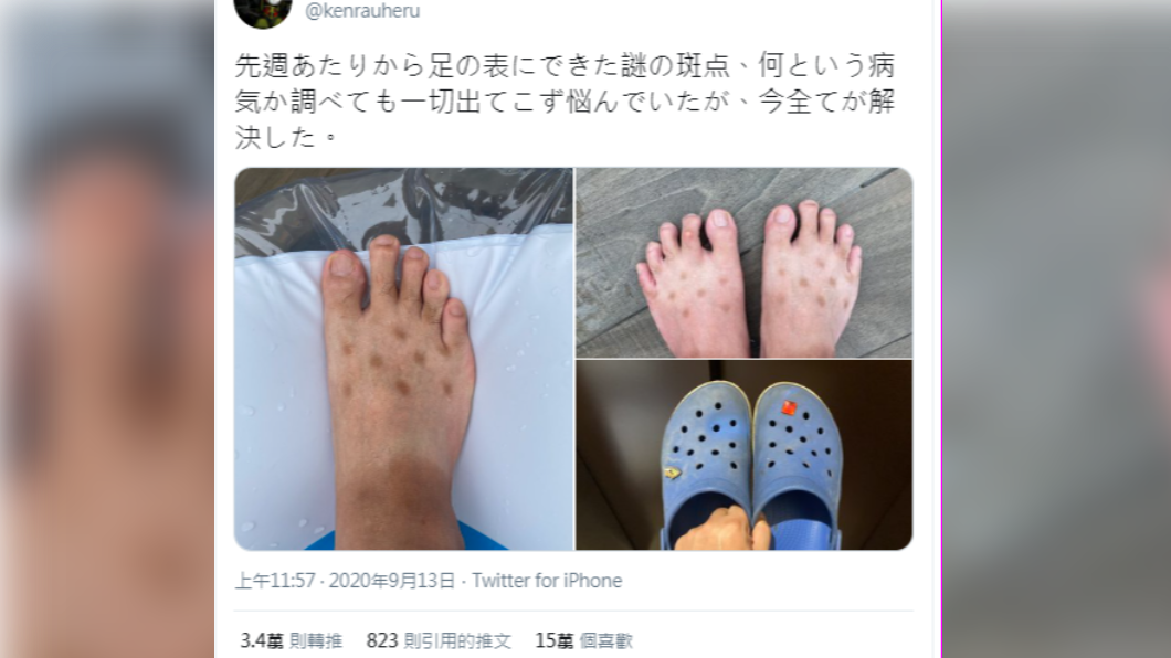 男子恍然大悟腳背的褐色斑點原來是涼鞋所致。(圖/翻攝自@kenrauheru Twitter)
