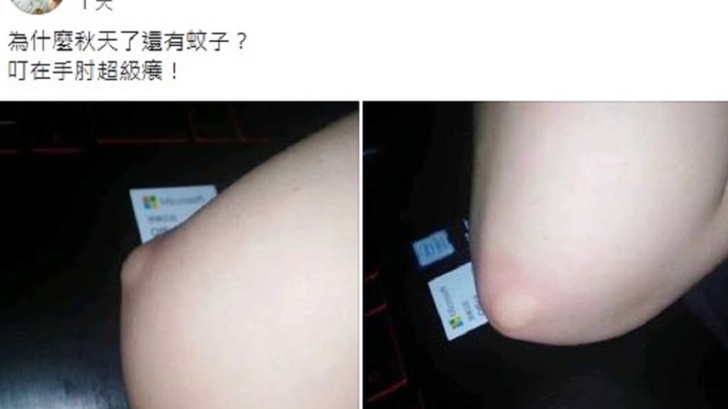 原PO貼出照片抱怨蚊子叮咬。(圖/翻攝自「爆廢公社」)