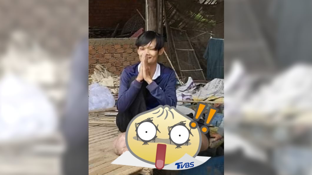 兒時被蚊子叮 拖21年沒就醫暴腫成「5倍大象腿」