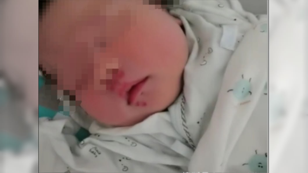 巴掌巨鼠利齒猛撕!11天大女嬰「全身肉綻」血染整衣