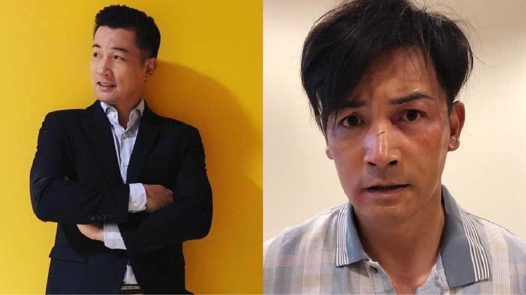 推倒逾百公斤老父濺血!男星哽咽曝原因