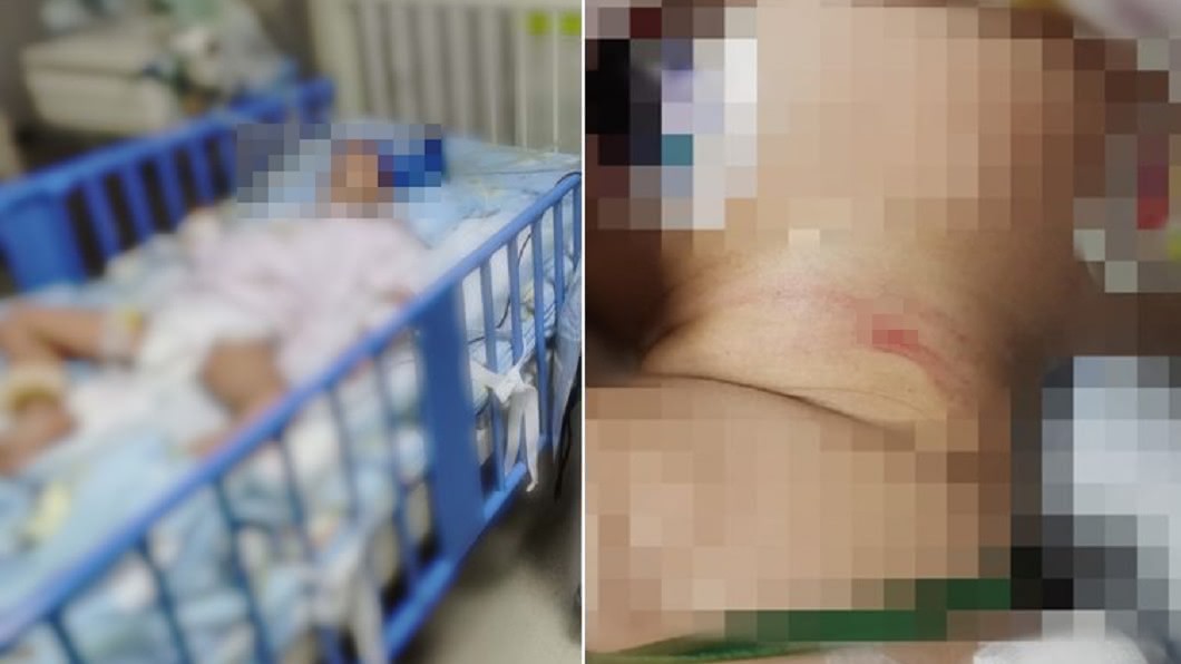 關車窗開冷氣…4歲女「心跳驟停」抽搐 醫驚:頸椎變形