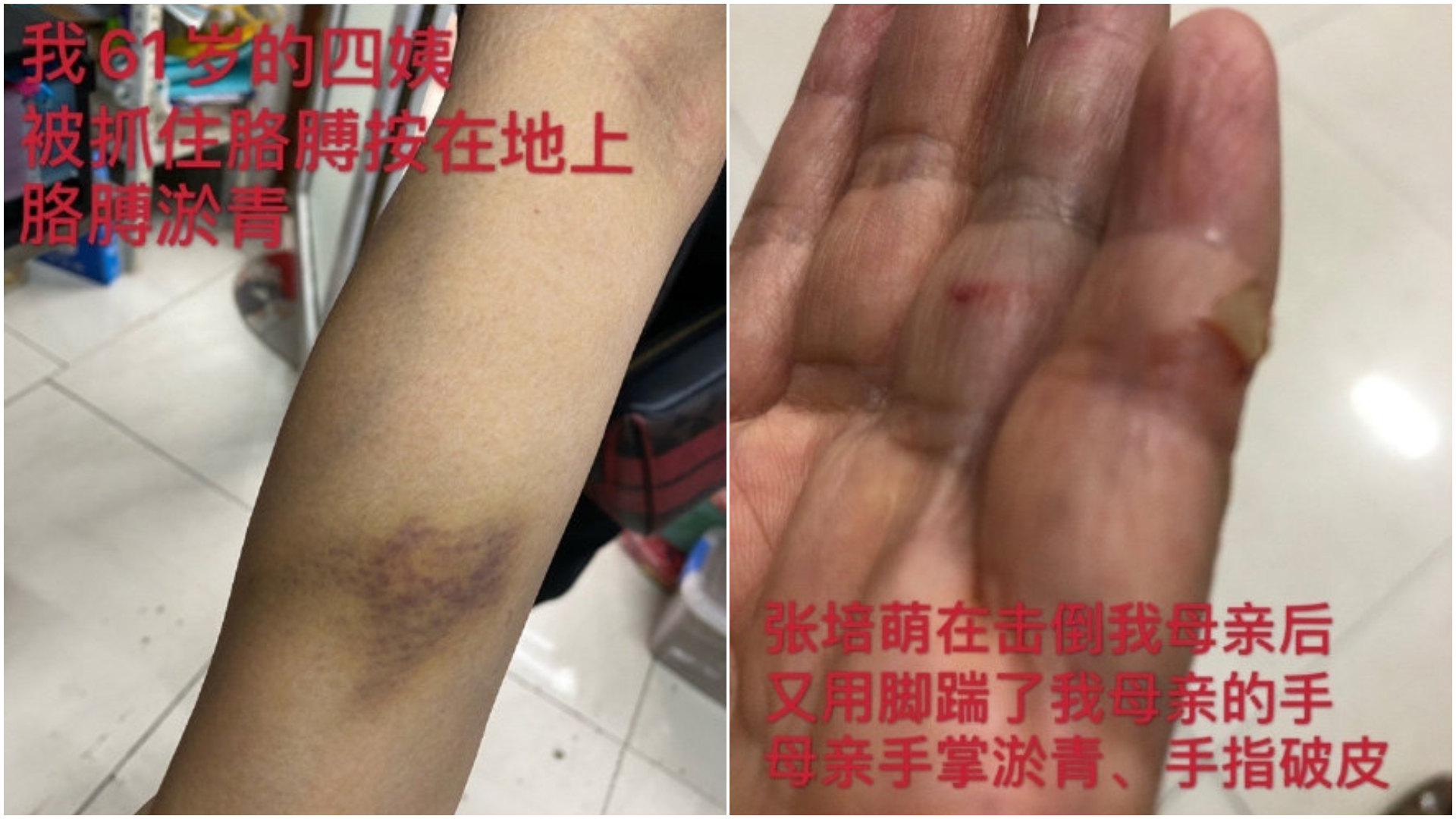 家人也遭張培萌毆打攻擊。(圖/翻攝自張莫涵微博)