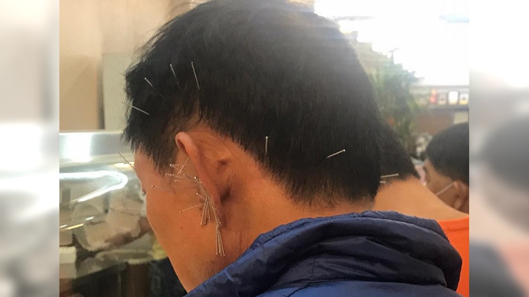 超密集!便當店男「頭上扎滿針」 網崩潰:跌倒就慘了