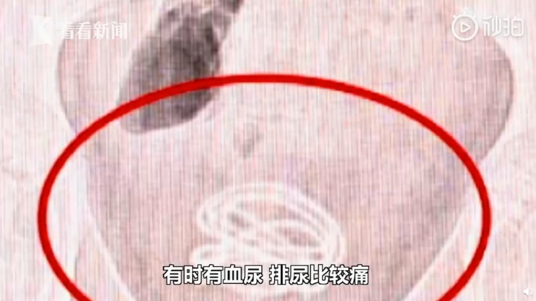 (圖/翻攝自看看新聞)