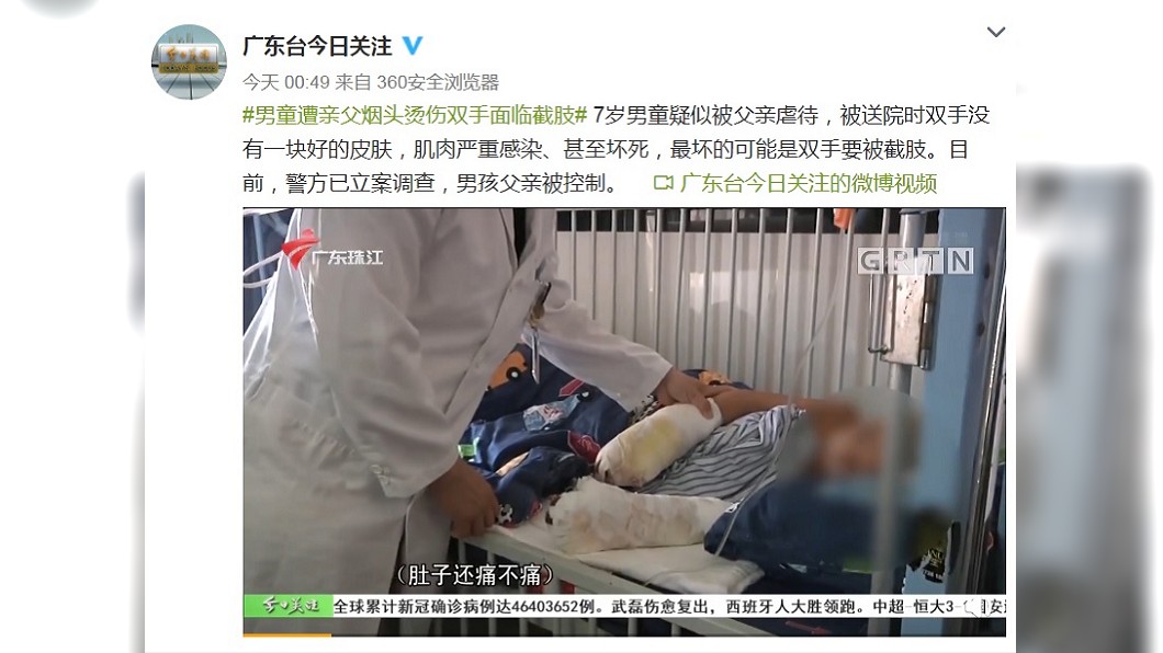 廣東台報導男童受虐事件。（圖／翻攝自廣東台今日關注微博）