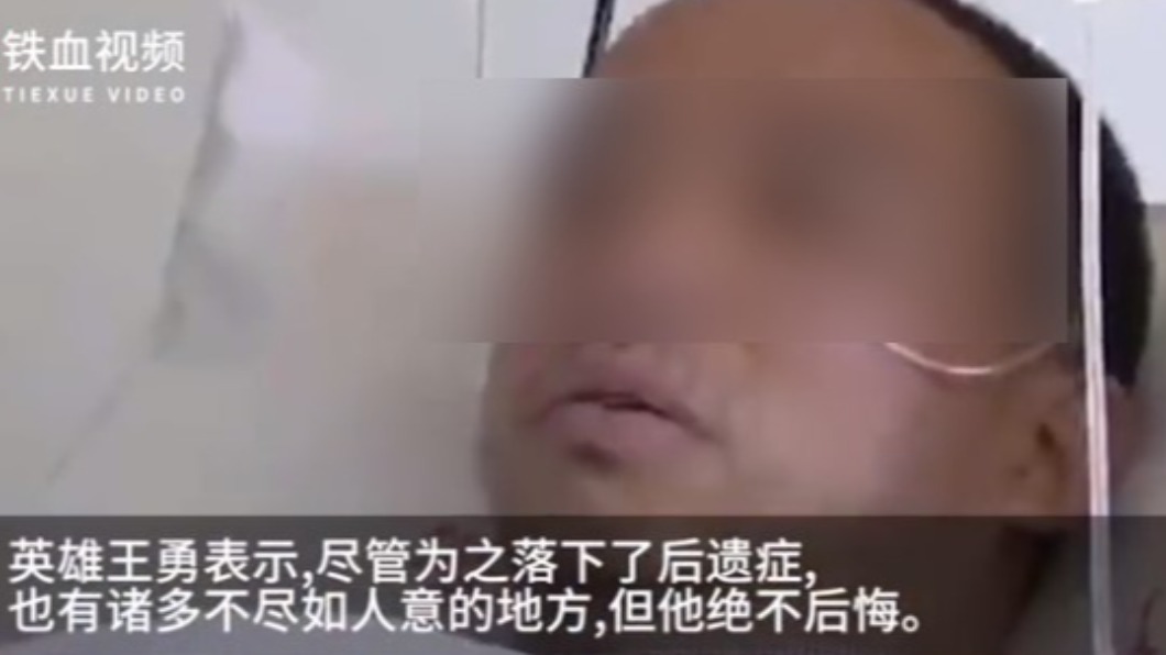 王勇救出男童後留下後遺症。(圖/翻攝自微博)