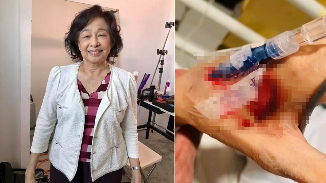 林利母親吊點滴後噴血。(圖/翻攝自林利臉書)