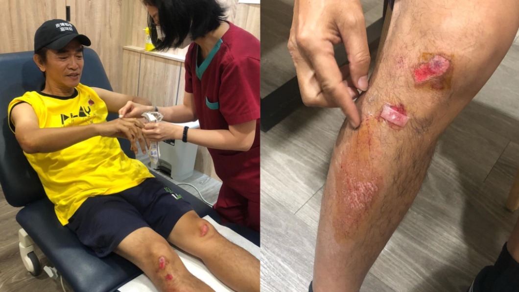 吳宗憲稍早在臉書報平安,透露明天將會做腦部斷層檢查。(圖/翻攝自吳宗憲臉書)