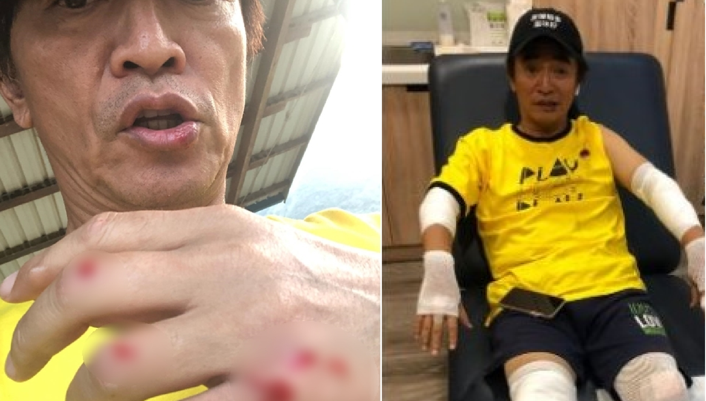 憲哥連人帶車慘摔安全帽碎掉 7秒空拍畫面曝光:太血腥
