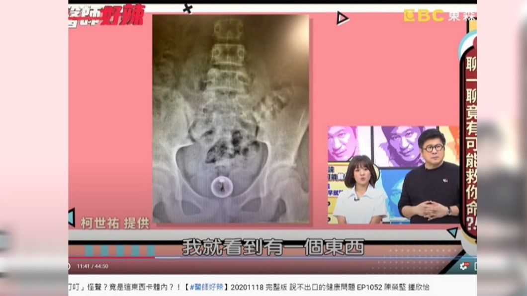 女子下腹藏有鈴鐺。（圖／翻攝自醫師好辣YouTube）