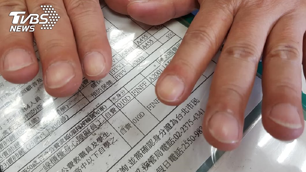 「杵狀指」手指尖端腫起。（圖／胸腔重症醫師蘇一峰授權提供）