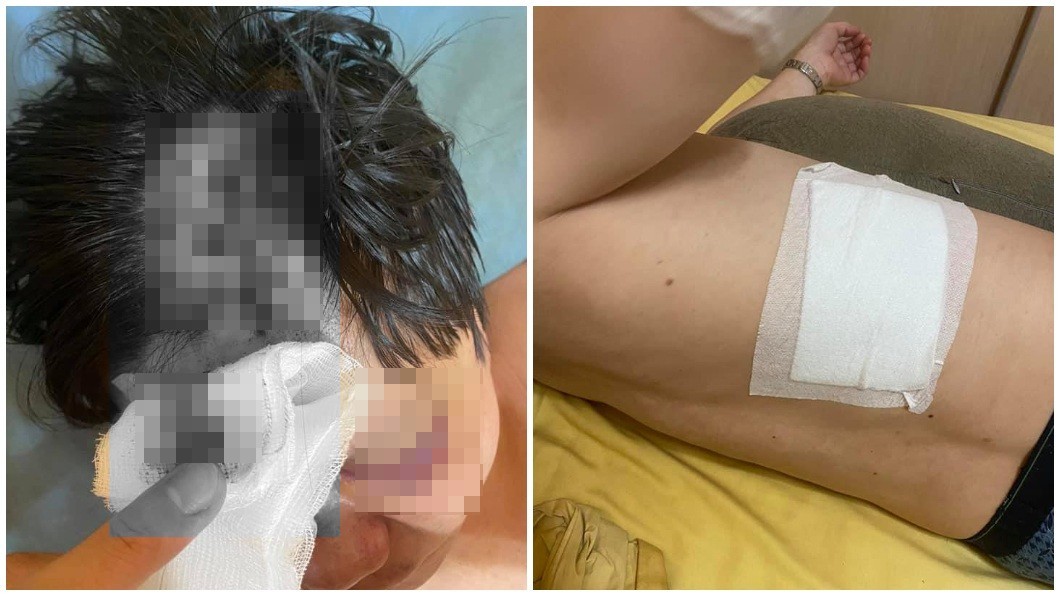 唱歌消費被「阿姨級酒女」強制坐檯 男控遭剝皮還被狂毆