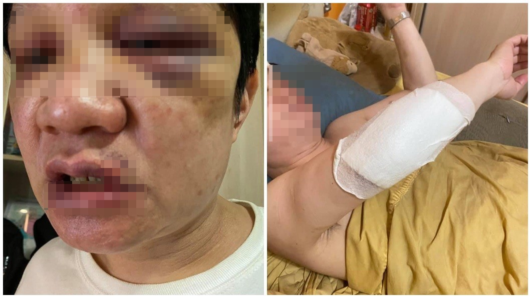 男子被送醫急救後所幸並無大礙,但堅持對動手的員工和在場客人提告。(圖/翻攝自爆料公社)