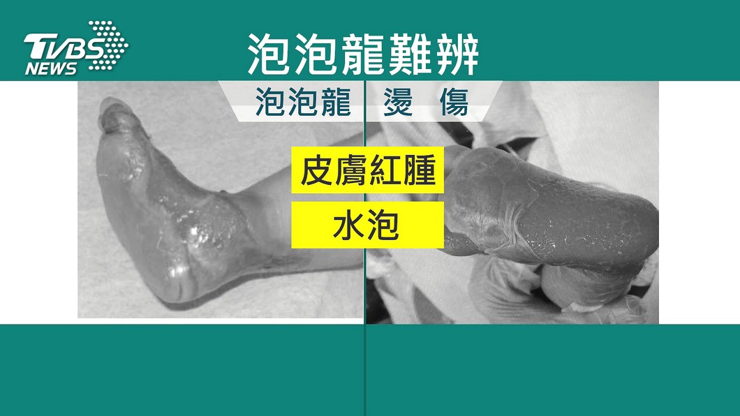 圖/TVBS(非當事畫面)