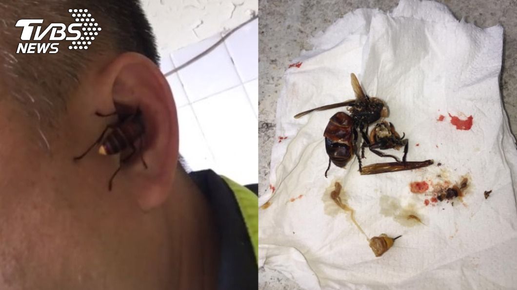 活人生吃!台中警遭虎頭蜂「啃耳5分鐘」 咬掉一塊肉