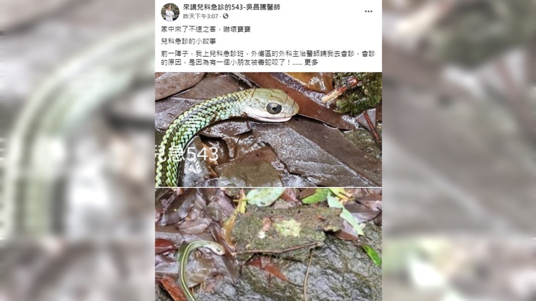 孩童在家中慘遭蛇吻送醫治療。(圖/翻攝自「來講兒科急診的543-吳昌騰醫師」)