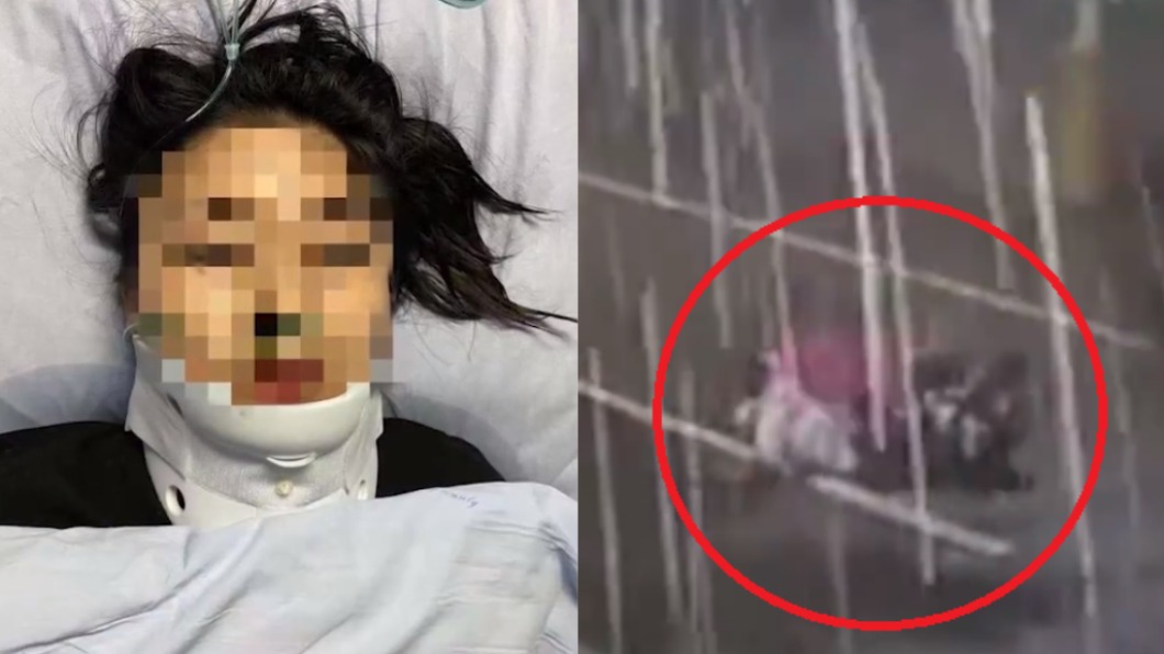 「15秒遭撞2次」女騎士全身骨折　2肇事駕駛倒車逃