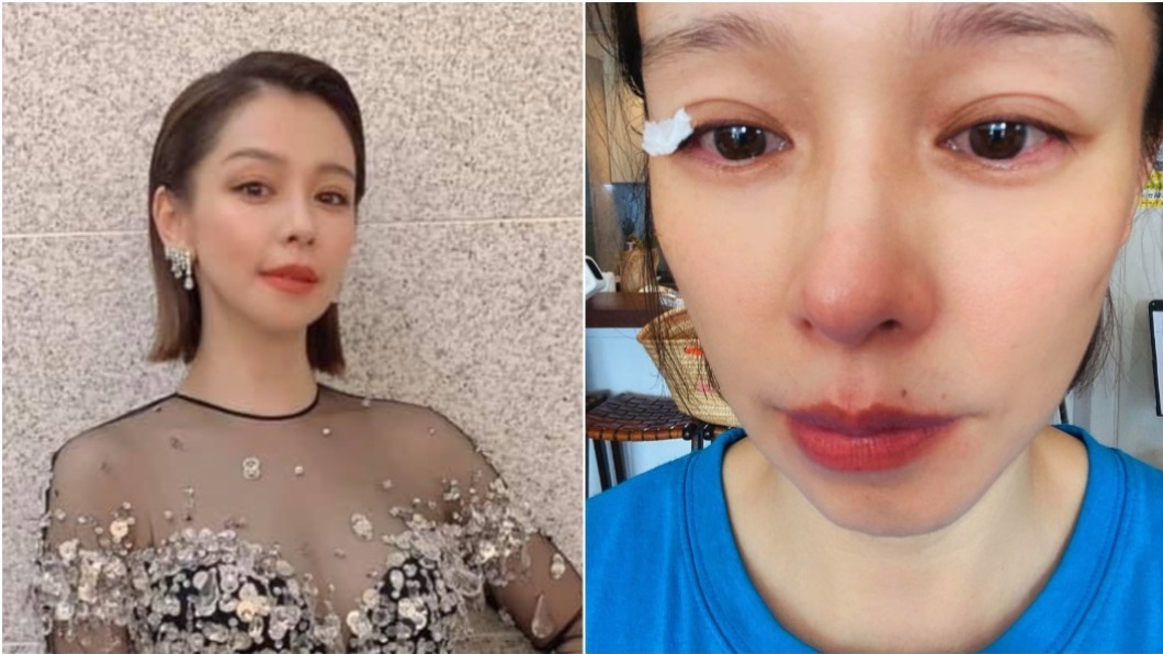臥病床「大號得求人幫忙」 徐若瑄淚:真的沒尊嚴!