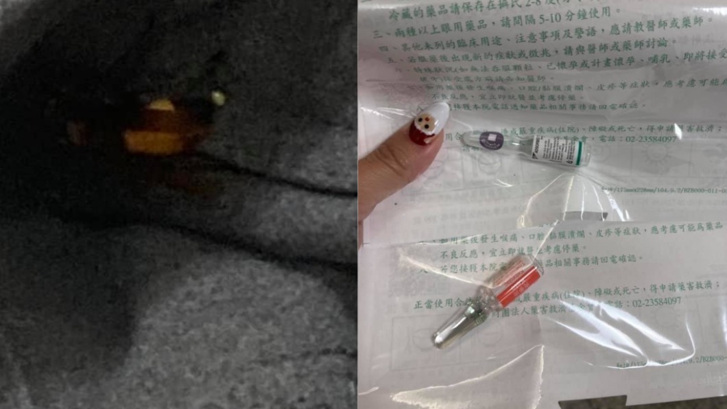 人妻穿褲啪一聲腿爆痛 驚見「虎頭蜂藏口袋」急送醫