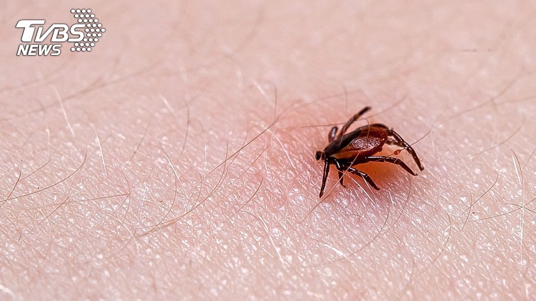 今年首例境外移入萊姆病 美籍男居檢發病確診