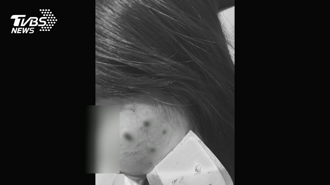 危險!河堤違規放炮 母Po網控女兒被炸傷