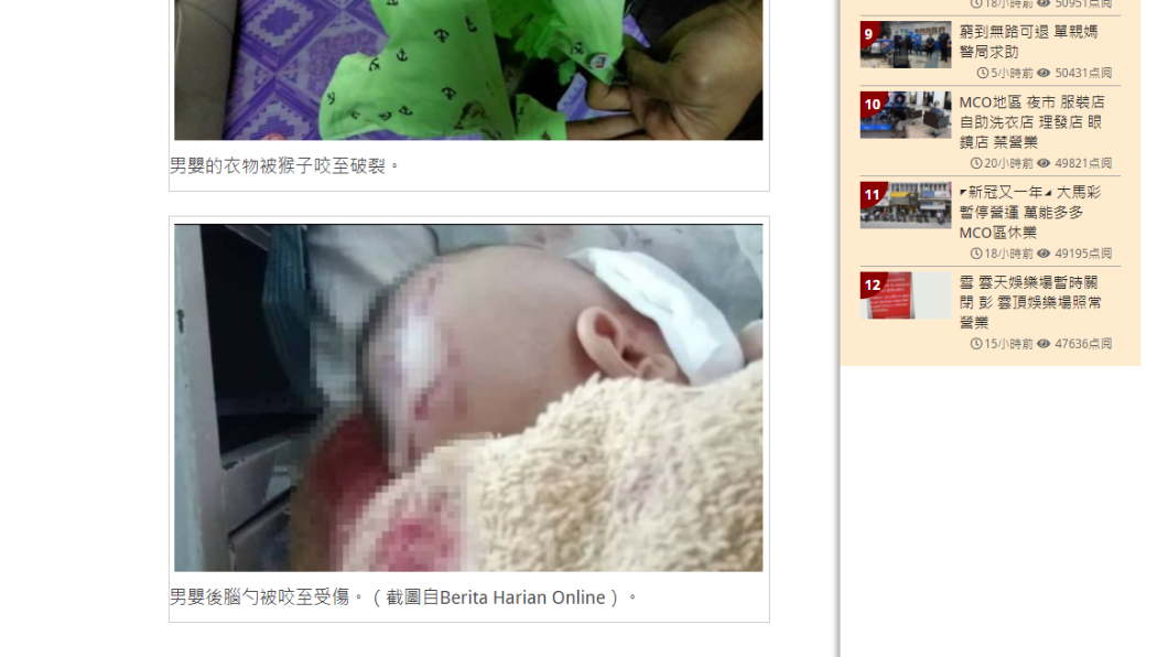 男嬰全身多處遭咬傷。(圖/翻攝自中國報)