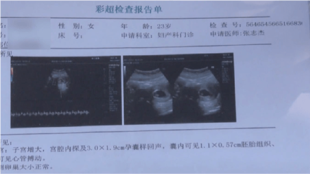 女子術後2天出現噁心想吐,就醫檢查後發現懷孕,她認為美容機構並未告知有明顯疏失而提告求償。(圖/翻攝自浙江交通之聲)