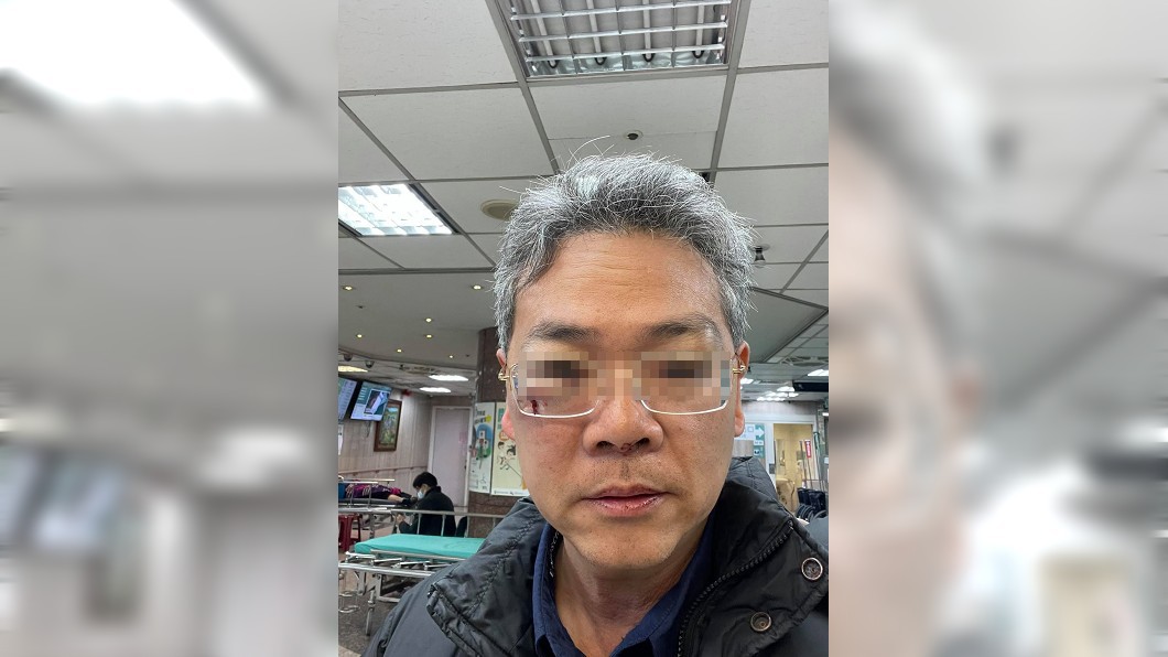 年輕人飛航管制區爽放鞭炮 男勸阻反被揍成「熊貓眼」