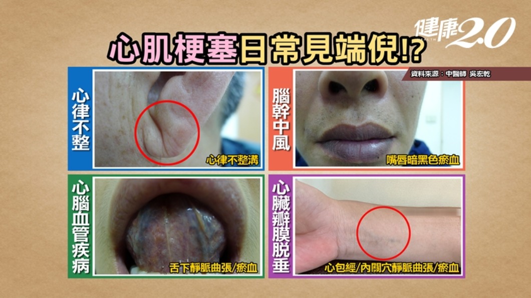 (圖/《健康2.0》)