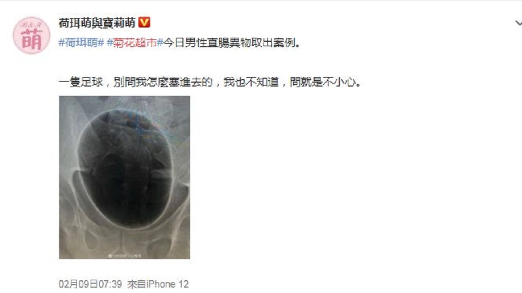 這起離奇事件引發網友們熱烈討論。(圖/翻攝自微博)
