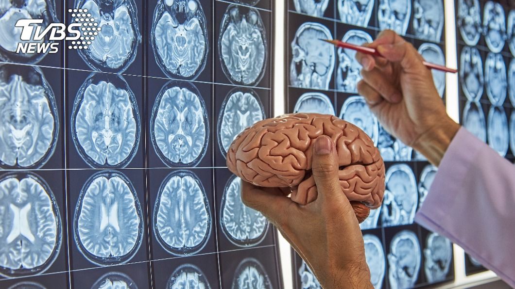 中研院最新大腦研究 蛋白不穩定恐致智能障礙
