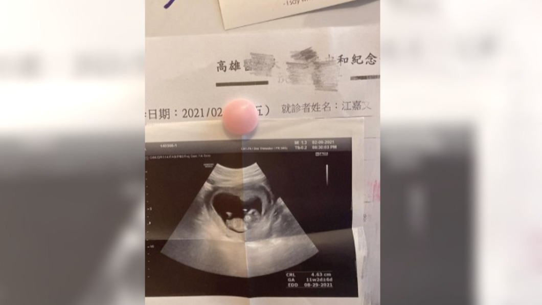 罔腰貼出超音波照稱已懷孕。（圖／翻攝自罔腰IG）
