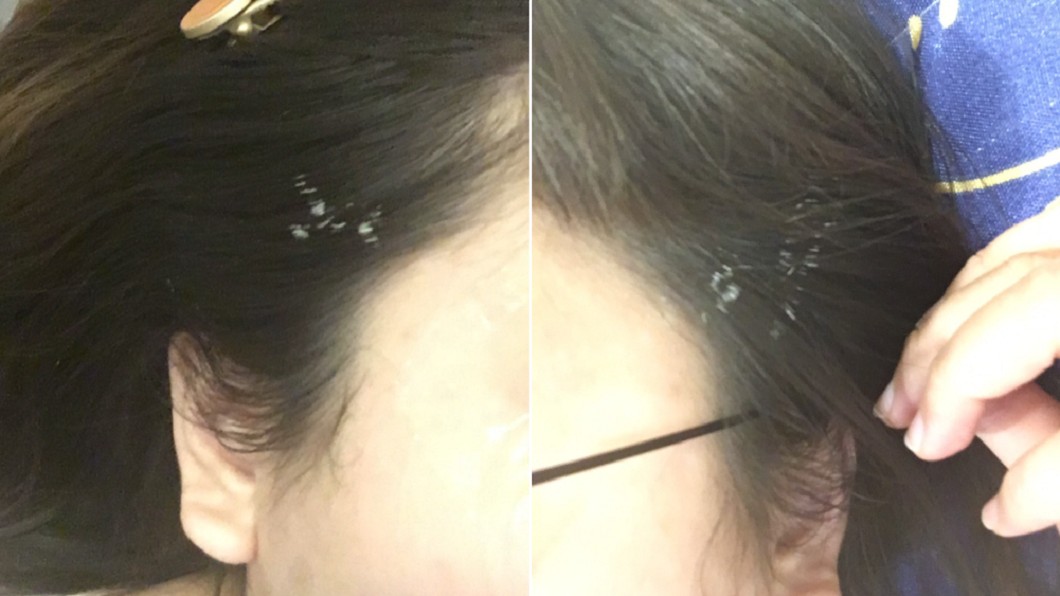 進廠維修慘遭「雷射漂髮」 女照鏡子崩潰:想剪掉!