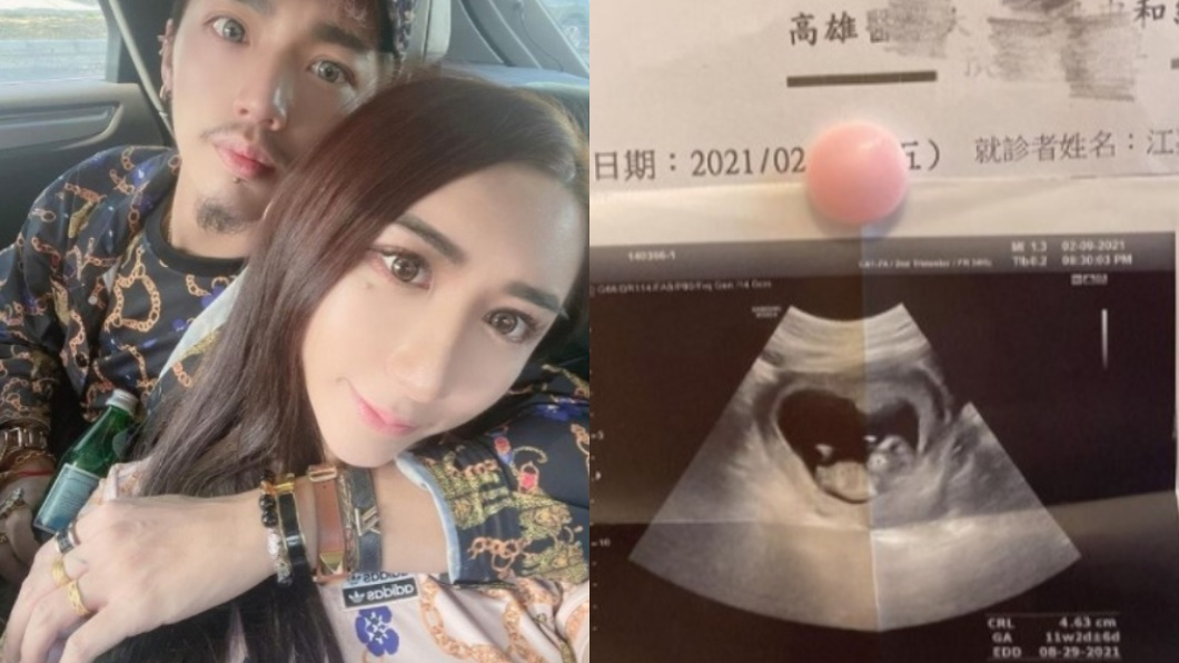 罔腰秀胎兒超音波 不孕症名醫揪「關鍵疑點」:不是她的