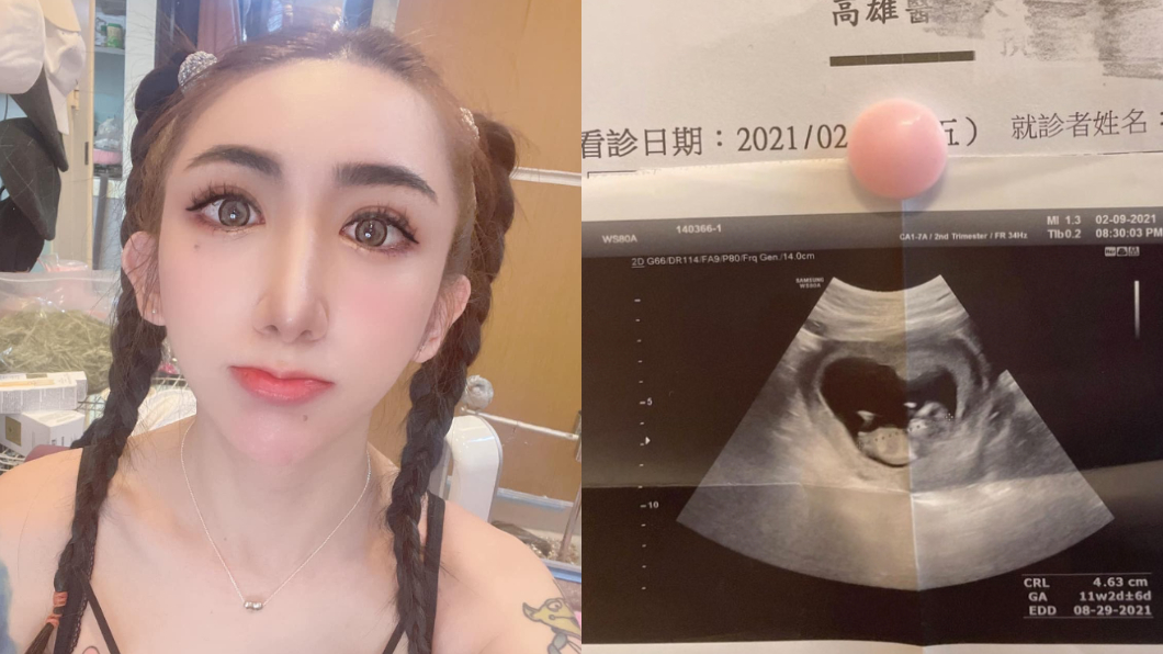 罔腰懷孕超音波照「來源曝光」 妹妹2018年臉書露餡