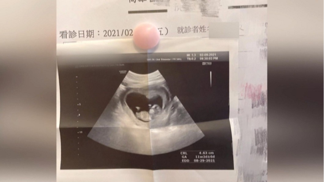 圖/翻攝自罔腰、男友IG