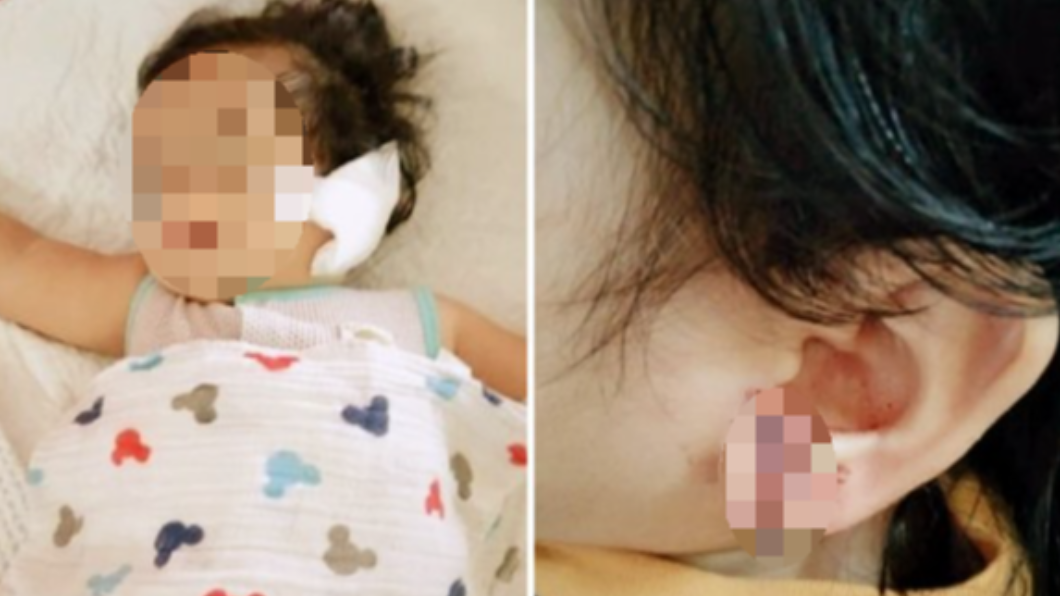 女嬰慘遭電風扇葉弄傷。(圖/翻攝自中國報)