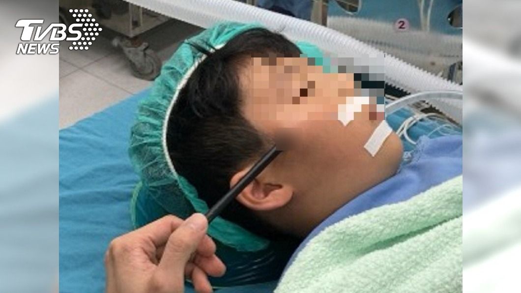 男童玩弓箭「80cm箭矢射中弟」 插進臉頰險爆眼球